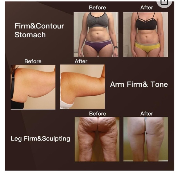 MLAY Radio Frequency Skin Tightening Machine - Picture 16 of 16